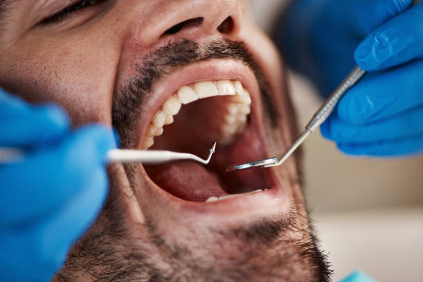 Best Emergency Dental Surgery in Oakwood, IL