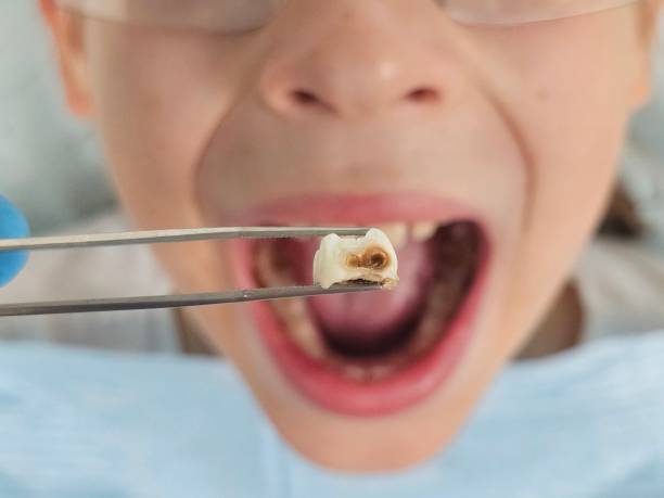 Best Emergency Broken Tooth Repair in Oakwood, IL